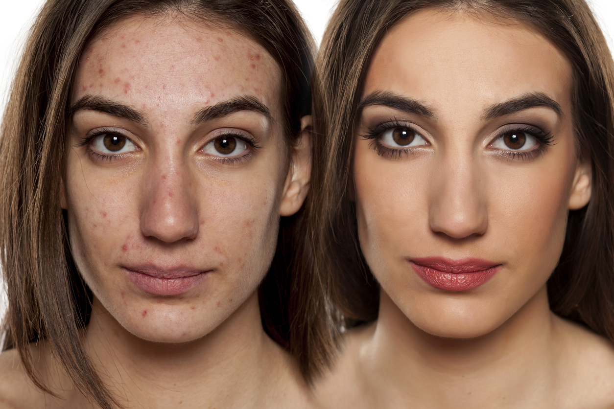 Frequency separation for photographers — precision skin retouching with preserved texture